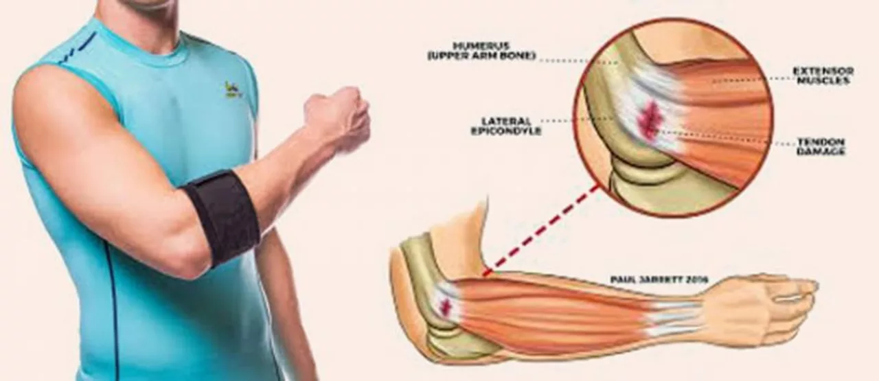 Runners knee, tennis elbow, and bad shoulders?